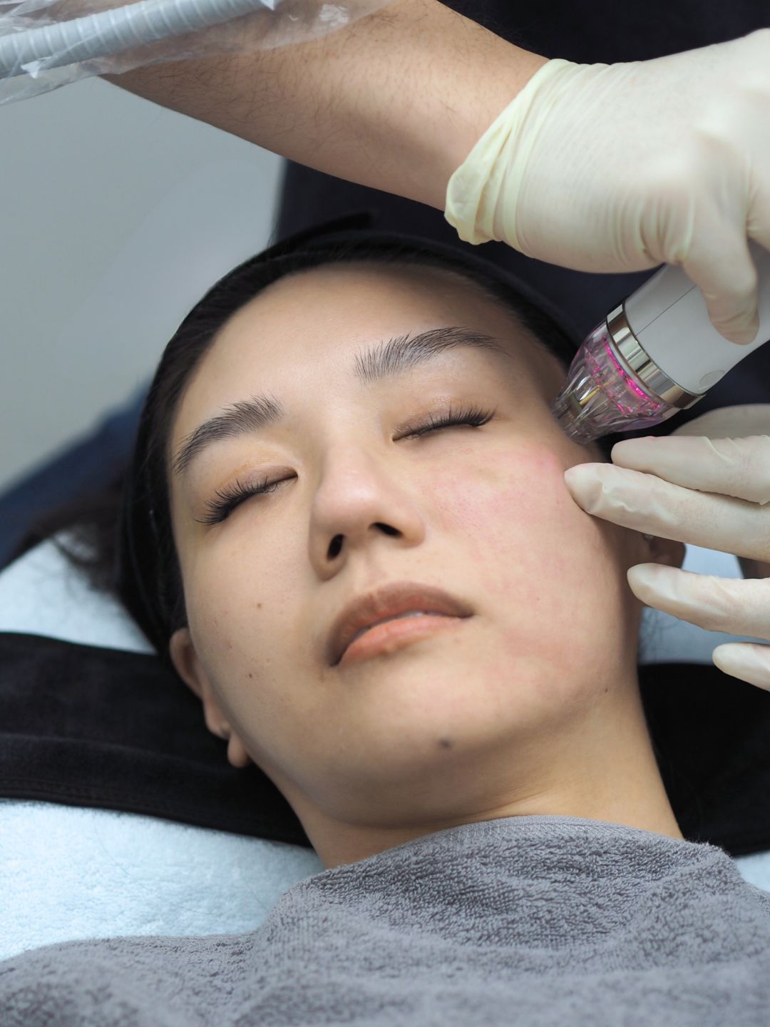 Treatment journey