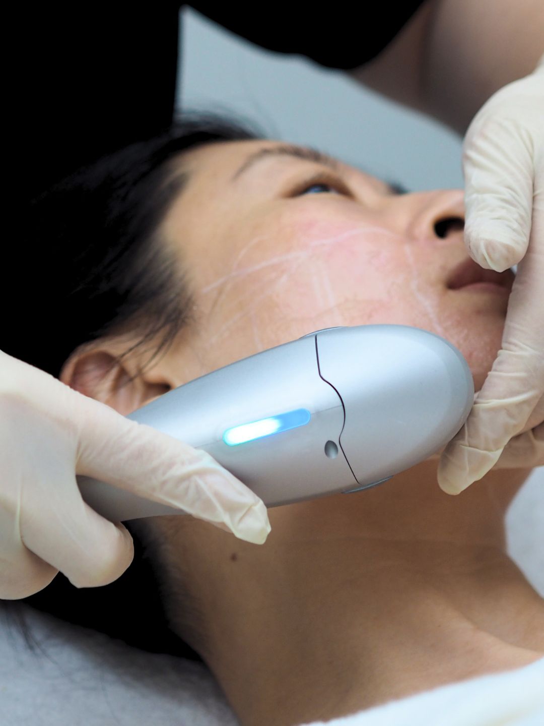 Treatment journey