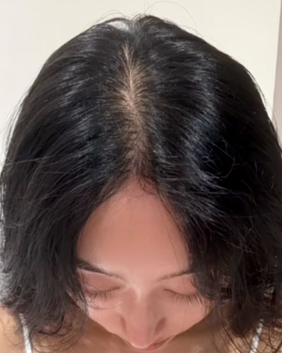 After treatment