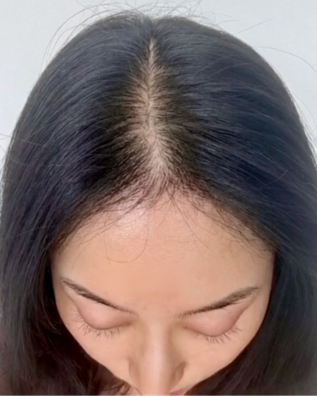 Before treatment