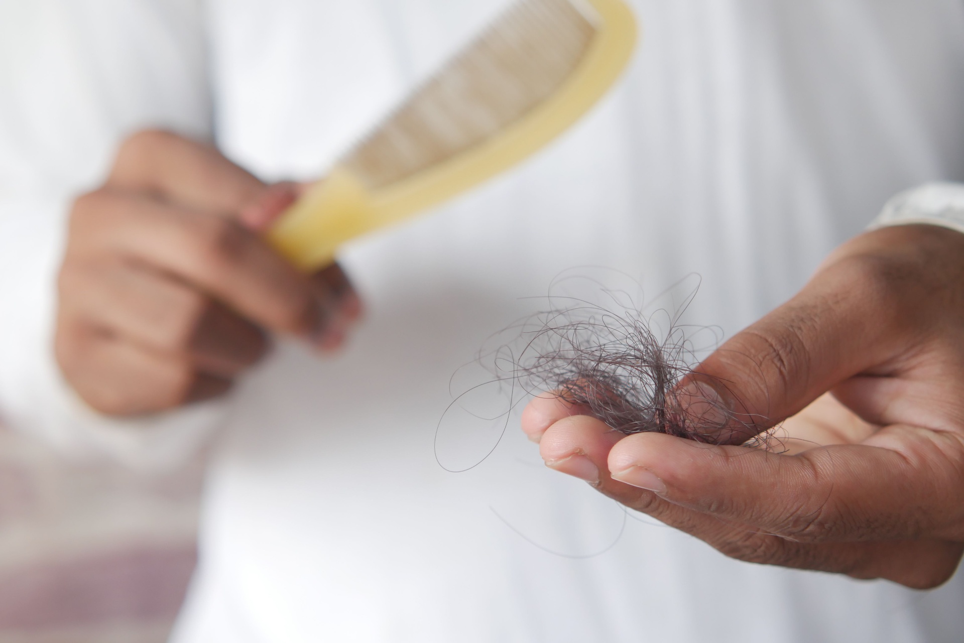 Gradual hair thinning