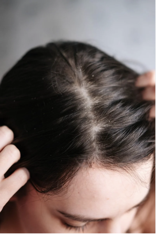 Scalp health & barrier function