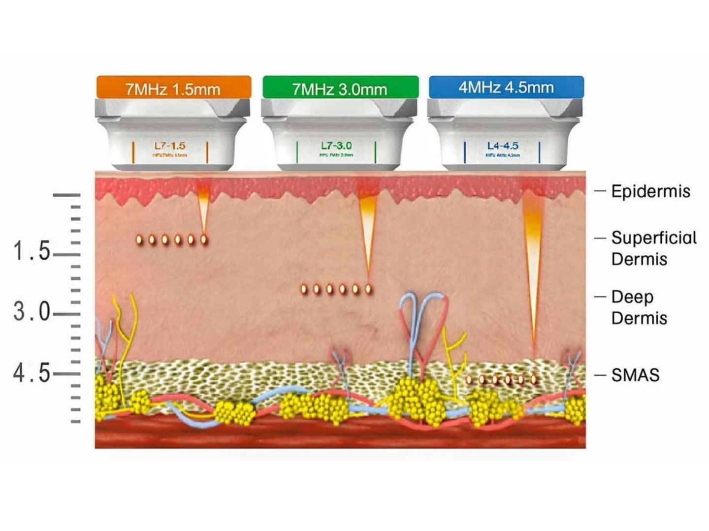 Treatment process