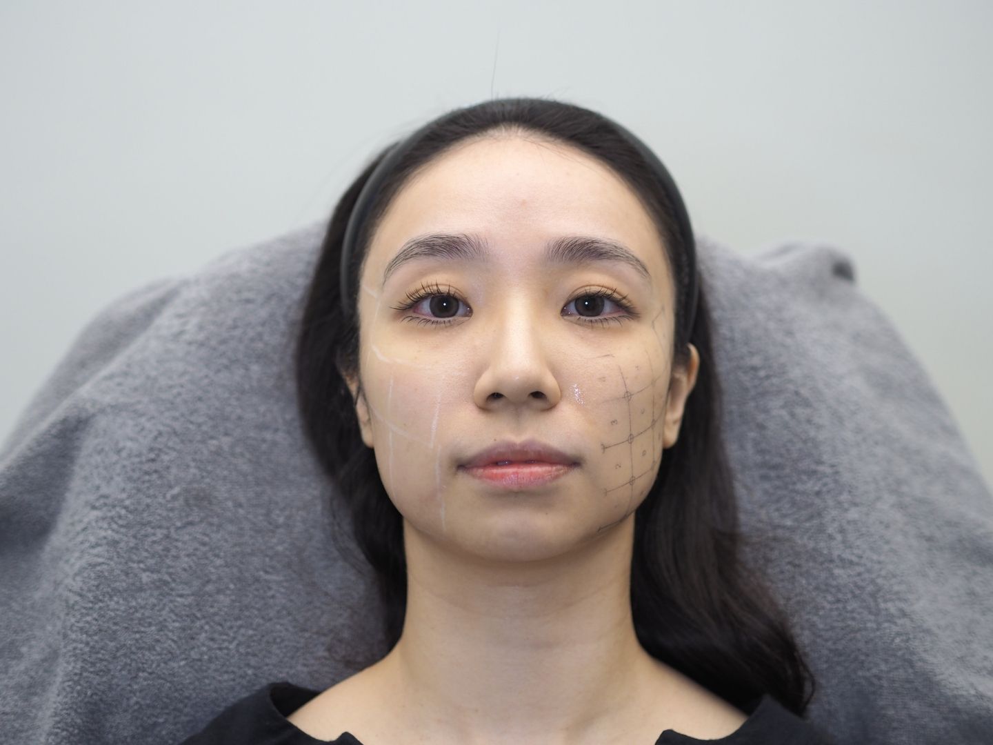 Treatment process