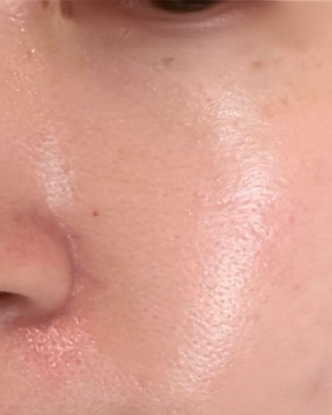 After treatment