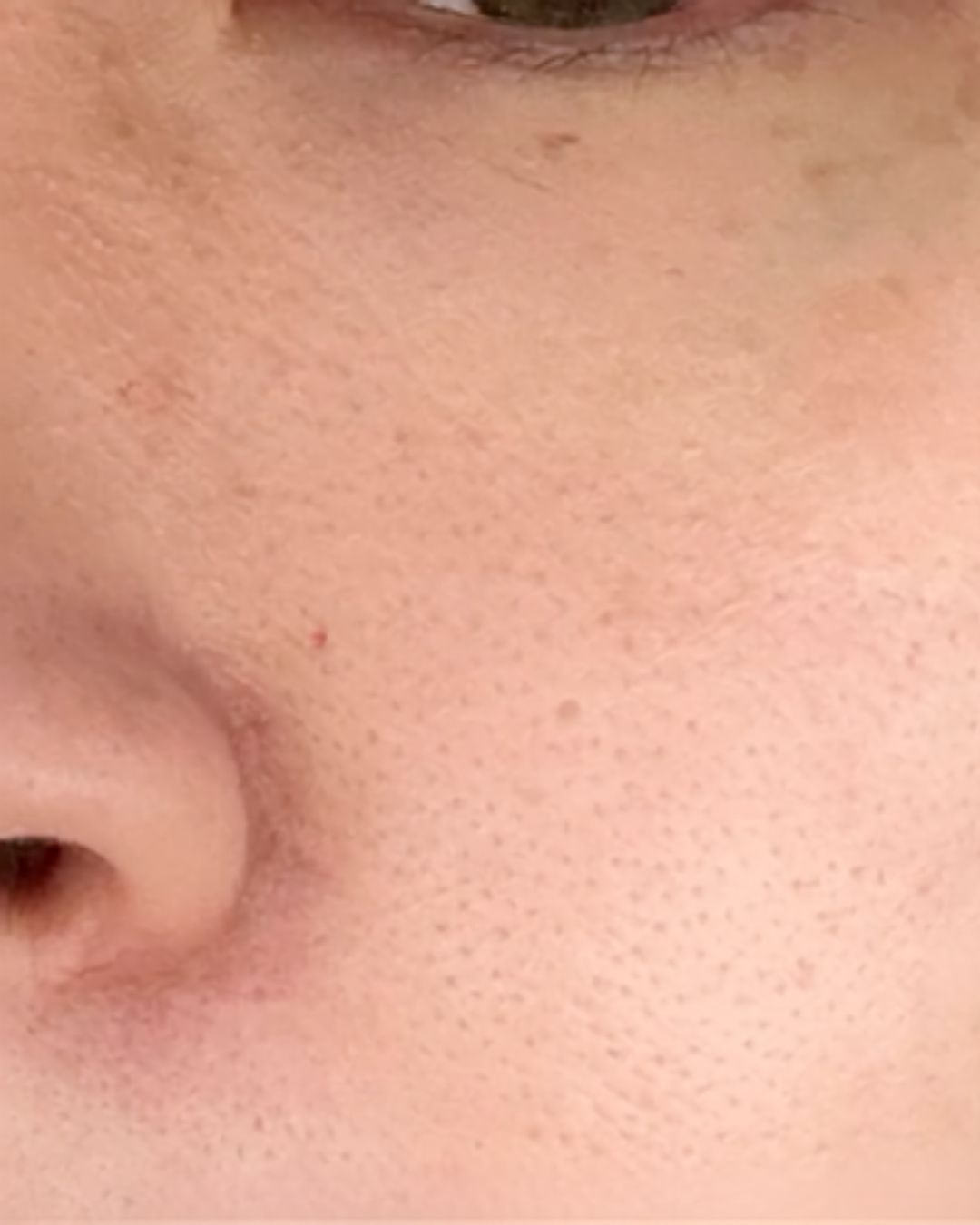 Before treatment