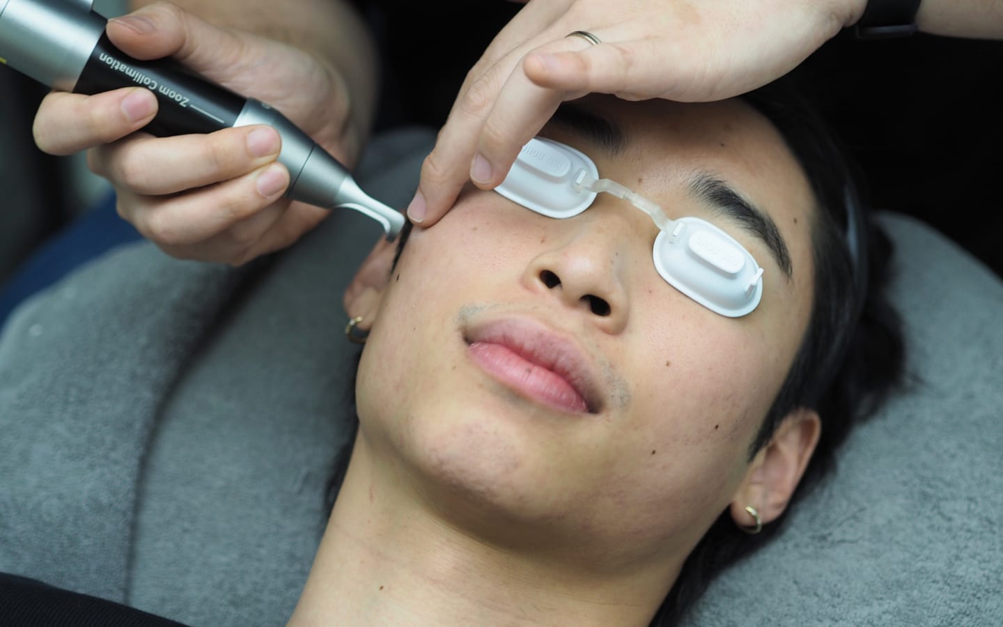 Pico Laser vs Fractional Laser: Which One Is Right for Your Skin?