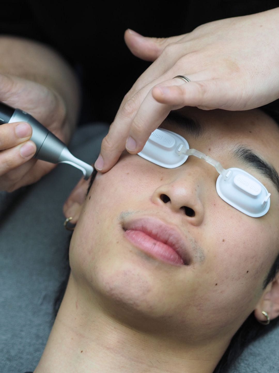 Skin treatment results