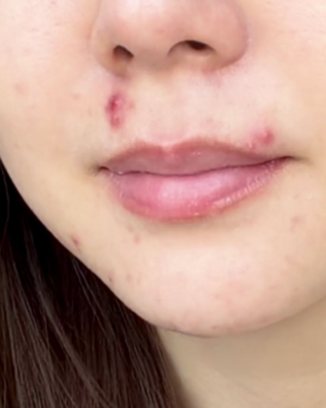 Before treatment