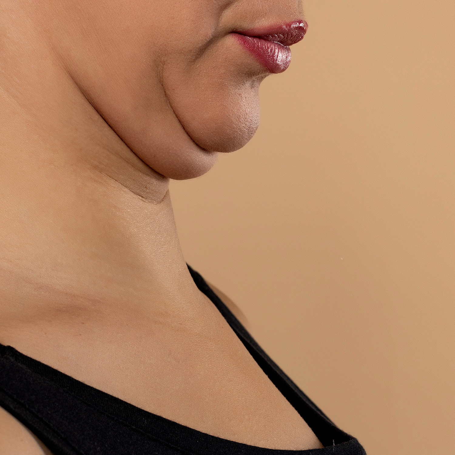 Poor Posture