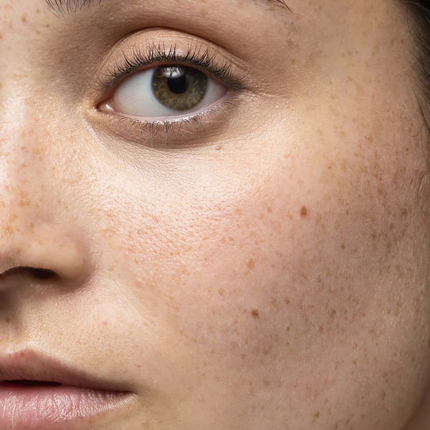 Post-Inflammatory Changes