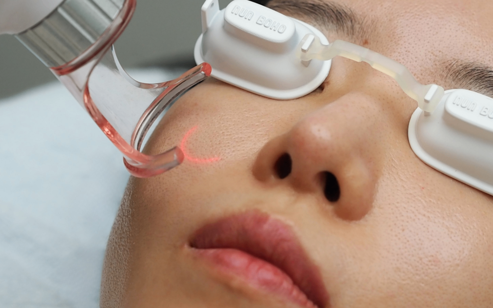 4-in-1 Tetra Laser
