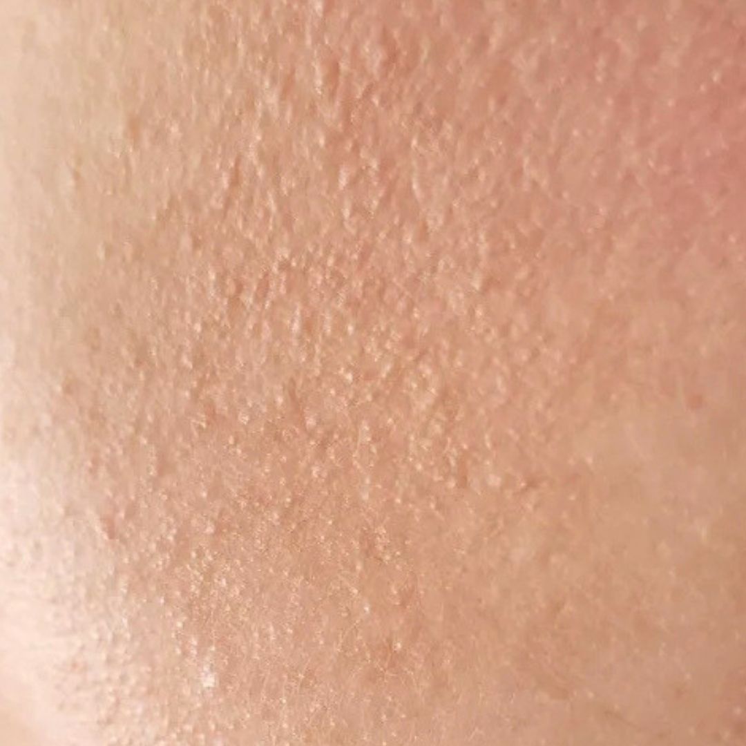 Rough Texture