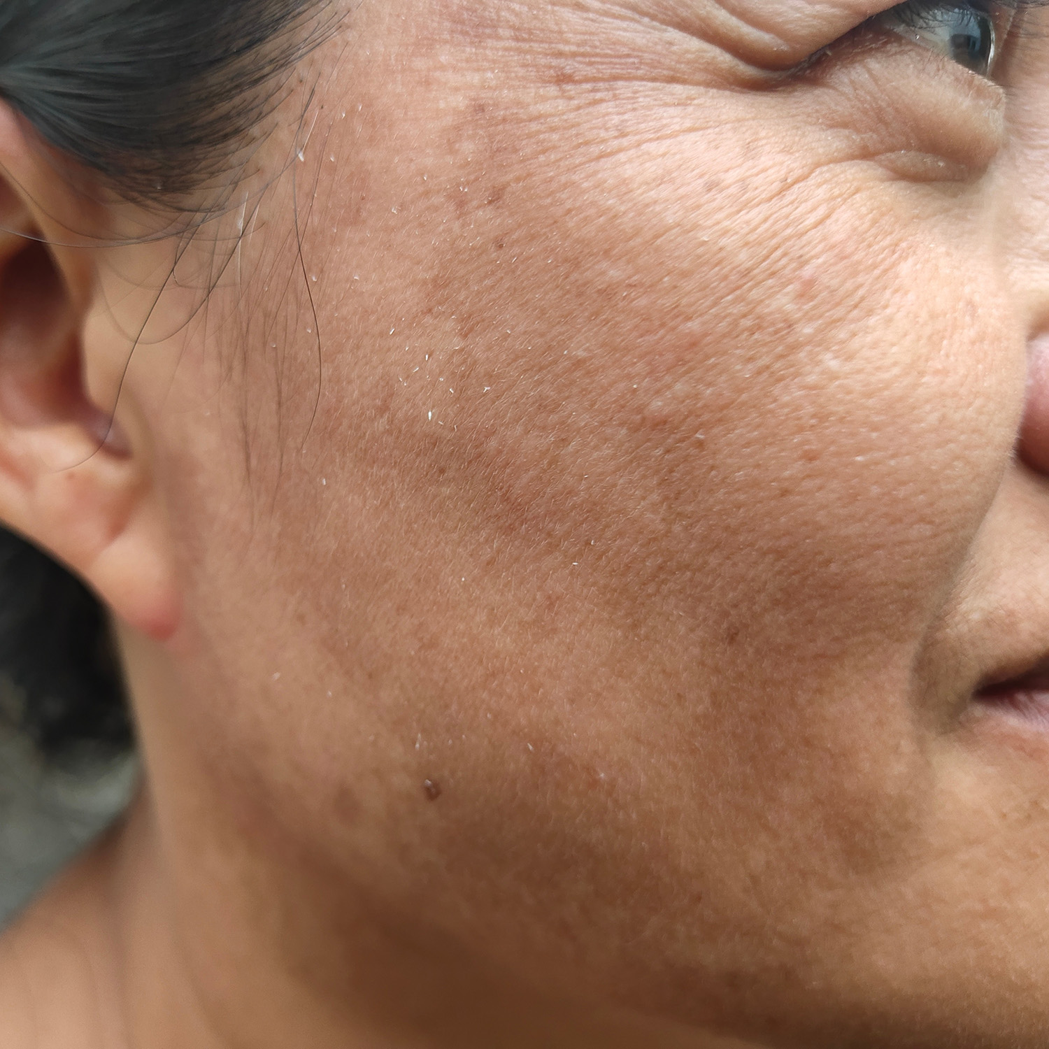 UV Damage & Pollution